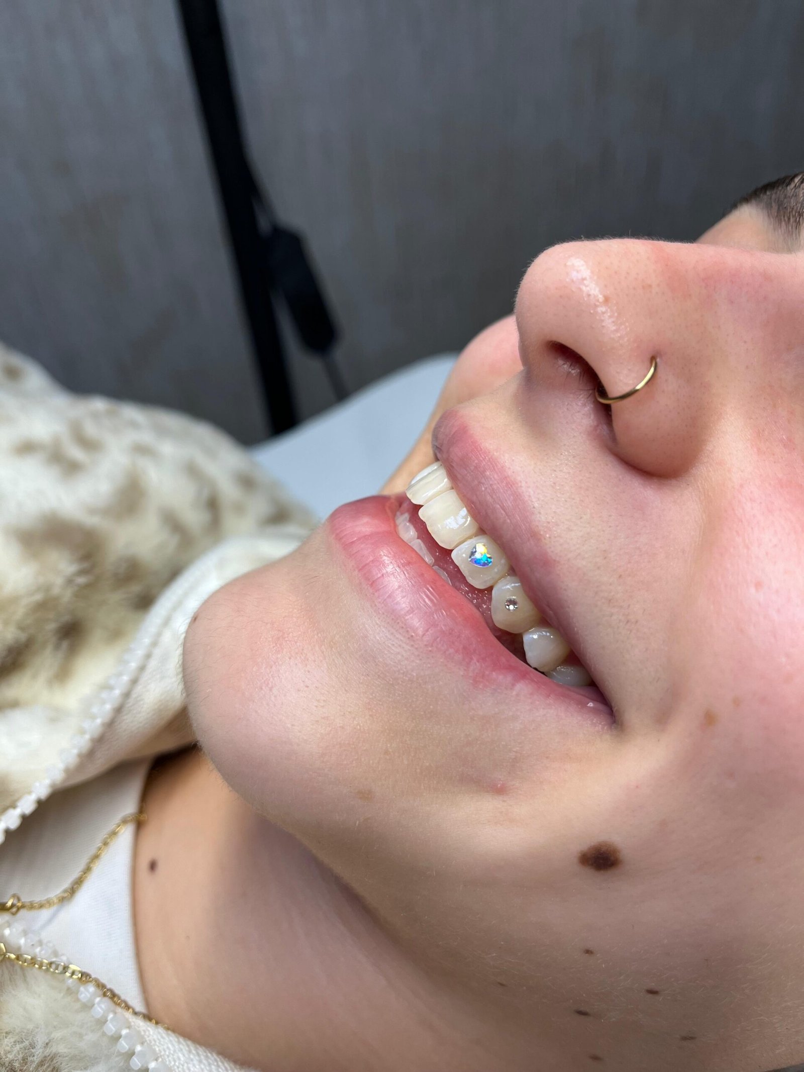 gemas dentales en Velilla de San Antonio